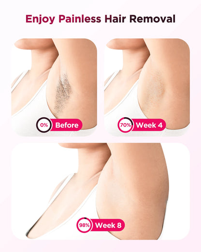 IPL Laser Hair Removal Device Ice-Cooling 3 in 1 Painless